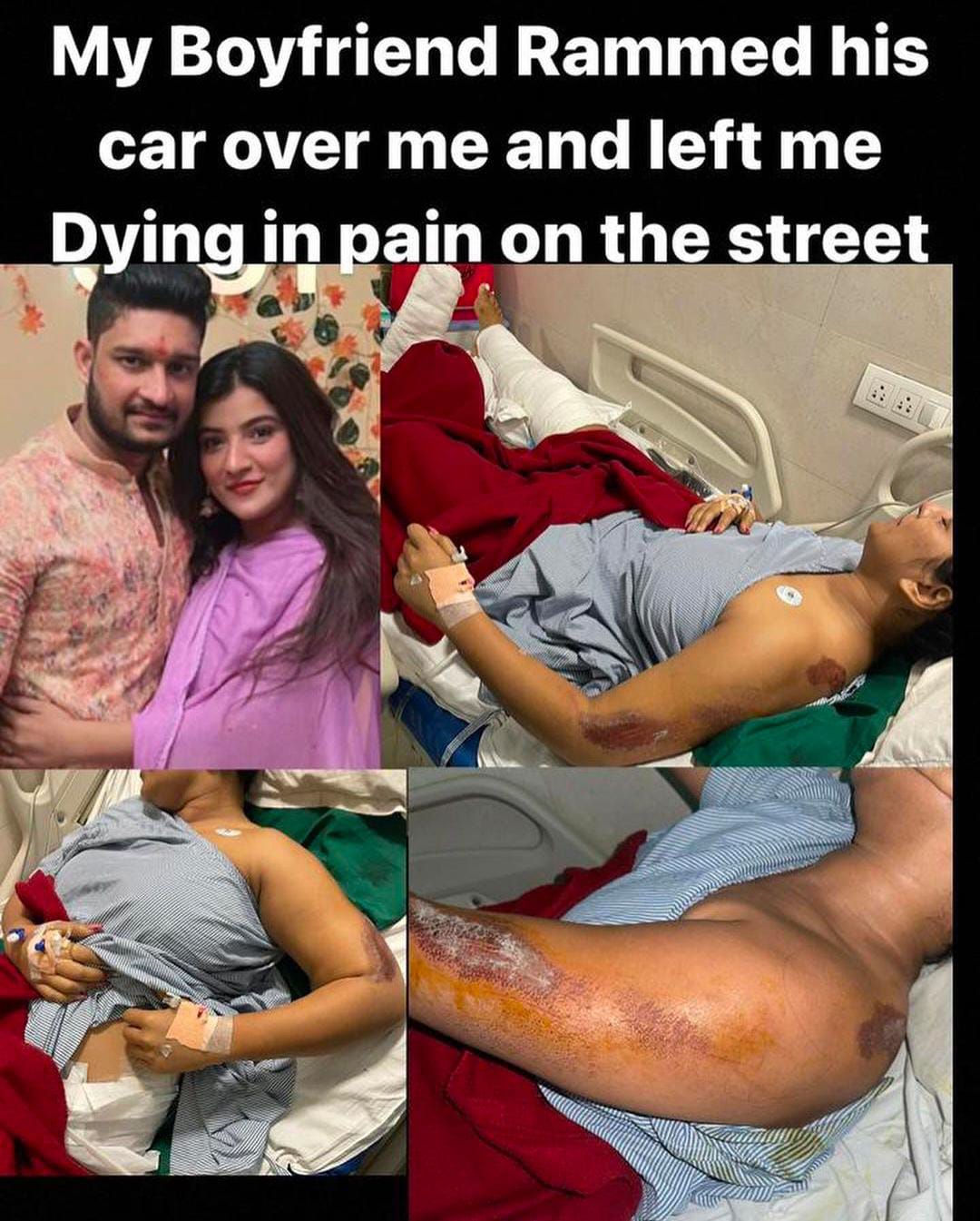 In a shocking incident, a 26-year-old woman was severely injured after her boyfriend allegedly tried to run her over with his car in Maharashtra Thane.
