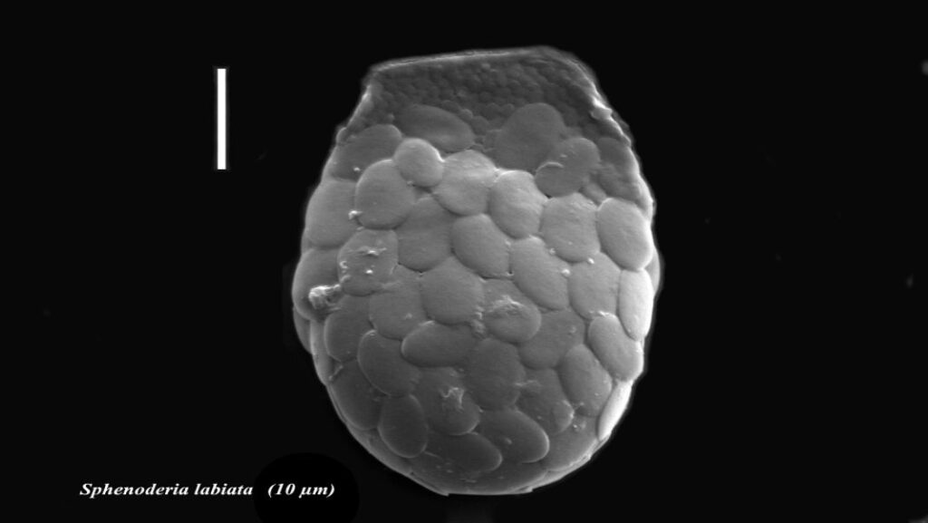 From Meghalaya’s waters to Arunachal’s forests, microscopic life reveals Northeast India’s hidden biodiversity